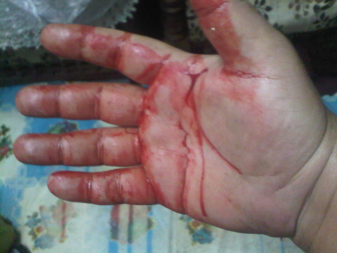 Krev mučedníka Sherifa, fotografa, kterého zabily milice Muslimského bratrstva, na mé ruce, Elagamytarek